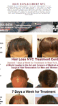 Mobile Screenshot of hairreplacementnyc.org